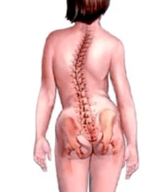 Pathologie van het musculoskeletale systeem