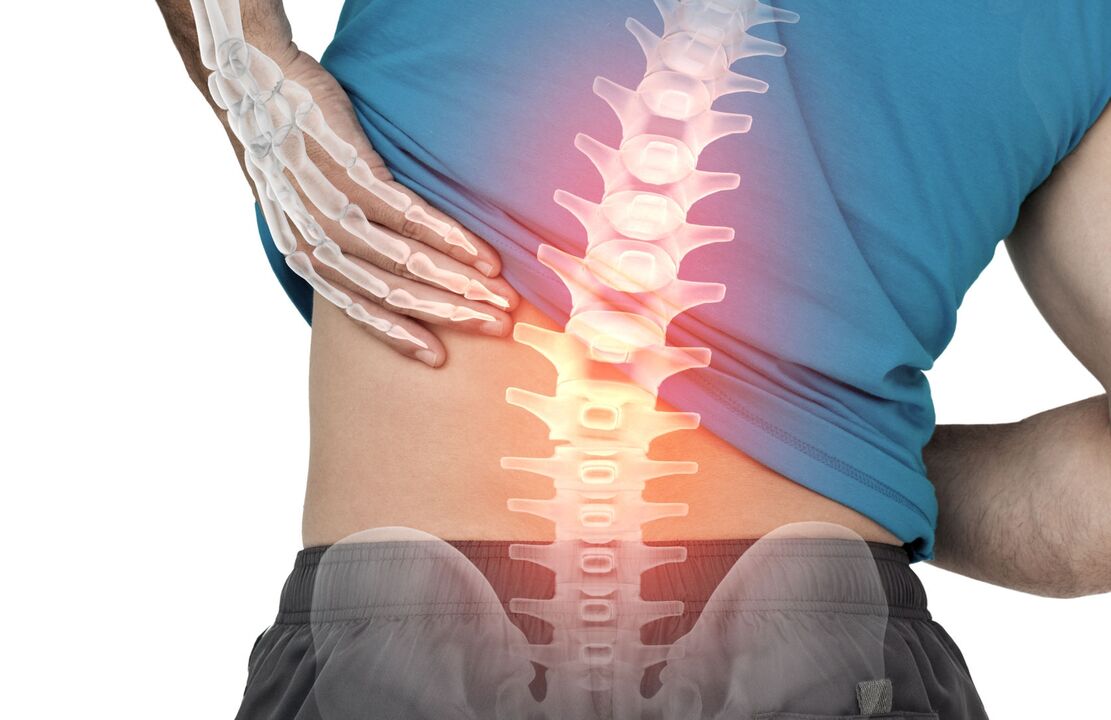 Het gevaar van ostechondrose van de lumbale