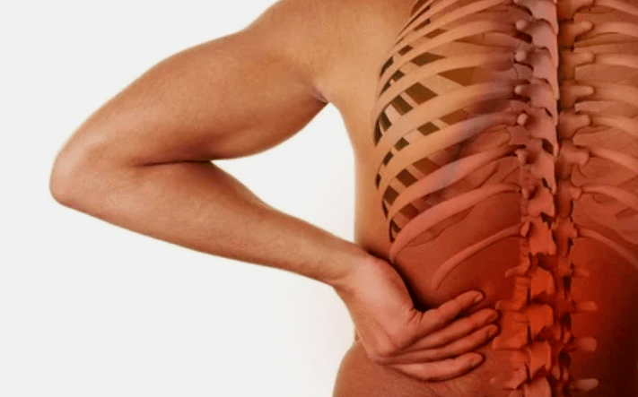 De oorzaken van osteochondrose van de lumbale