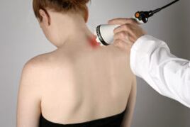 Behandeling van cervicale osteochondrose met lasertherapie