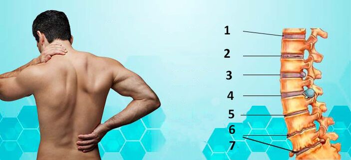 ontwikkelingsstadia van osteochondrose